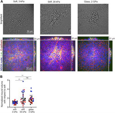 A Stiff Extracellular Matrix Favors the Mechanical Cell Competition that Leads to Extrusion of Bacterially-Infected Epithelial Cells